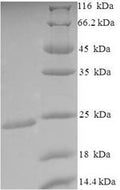Recombinant Escherichia coli O9:H4 Outer-membrane lipoprotein carrier protein (lolA) – Figure 1 of 1
