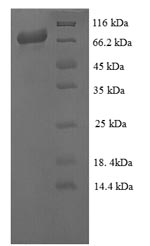 (Tris-Glycine gel) Discontinuous SDS-PAGE (reduced) with 5% enrichment gel and 15% separation gel.