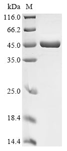(Tris-Glycine gel) Discontinuous SDS-PAGE (reduced) with 5% enrichment gel and 15% separation gel.