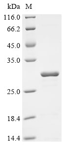 (Tris-Glycine gel) Discontinuous SDS-PAGE (reduced) with 5% enrichment gel and 15% separation gel.