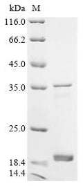 (Tris-Glycine gel) Discontinuous SDS-PAGE (reduced) with 5% enrichment gel and 15% separation gel.