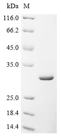 (Tris-Glycine gel) Discontinuous SDS-PAGE (reduced) with 5% enrichment gel and 15% separation gel.