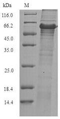Recombinant Geobacillus stearothermophilus Glycerol-1-phosphate dehydrogenase [NAD (P)+] (egsA) – Figure 1 of 1