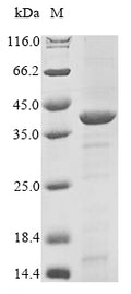 (Tris-Glycine gel) Discontinuous SDS-PAGE (reduced) with 5% enrichment gel and 15% separation gel.