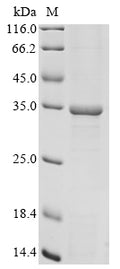 (Tris-Glycine gel) Discontinuous SDS-PAGE (reduced) with 5% enrichment gel and 15% separation gel.