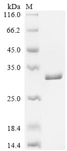 (Tris-Glycine gel) Discontinuous SDS-PAGE (reduced) with 5% enrichment gel and 15% separation gel.