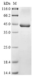 (Tris-Glycine gel) Discontinuous SDS-PAGE (reduced) with 5% enrichment gel and 15% separation gel.
