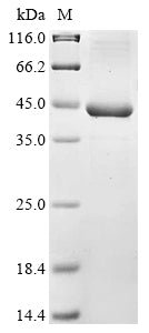 (Tris-Glycine gel) Discontinuous SDS-PAGE (reduced) with 5% enrichment gel and 15% separation gel.