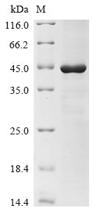 (Tris-Glycine gel) Discontinuous SDS-PAGE (reduced) with 5% enrichment gel and 15% separation gel.