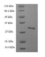 Recombinant Rotavirus A Non-structural glycoprotein 4, partial – Figure 1 of 1