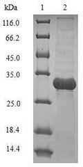 (Tris-Glycine gel) Discontinuous SDS-PAGE (reduced) with 5% enrichment gel and 15% separation gel.