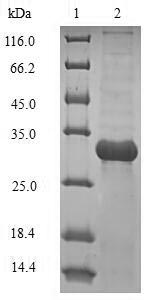 (Tris-Glycine gel) Discontinuous SDS-PAGE (reduced) with 5% enrichment gel and 15% separation gel.