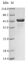 (Tris-Glycine gel) Discontinuous SDS-PAGE (reduced) with 5% enrichment gel and 15% separation gel.