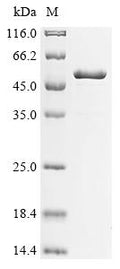 (Tris-Glycine gel) Discontinuous SDS-PAGE (reduced) with 5% enrichment gel and 15% separation gel.