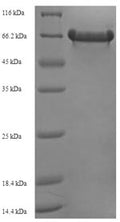 Recombinant Escherichia coli O127:H6 Trigger factor (tig) – Figure 1 of 1