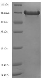 Recombinant Escherichia coli O127:H6 Trigger factor (tig) – Figure 1 of 1