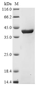 (Tris-Glycine gel) Discontinuous SDS-PAGE (reduced) with 5% enrichment gel and 15% separation gel.