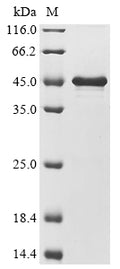 (Tris-Glycine gel) Discontinuous SDS-PAGE (reduced) with 5% enrichment gel and 15% separation gel.