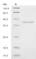 (Tris-Glycine gel) Discontinuous SDS-PAGE (reduced) with 5% enrichment gel and 15% separation gel.
