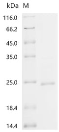 (Tris-Glycine gel) Discontinuous SDS-PAGE (reduced) with 5% enrichment gel and 15% separation gel.