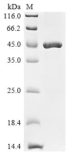 (Tris-Glycine gel) Discontinuous SDS-PAGE (reduced) with 5% enrichment gel and 15% separation gel.
