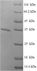 (Tris-Glycine gel) Discontinuous SDS-PAGE (reduced) with 5% enrichment gel and 15% separation gel.
