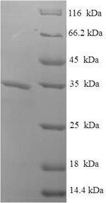 (Tris-Glycine gel) Discontinuous SDS-PAGE (reduced) with 5% enrichment gel and 15% separation gel.