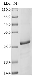(Tris-Glycine gel) Discontinuous SDS-PAGE (reduced) with 5% enrichment gel and 15% separation gel.