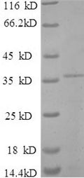 Recombinant Sulfolobus islandicus Chromatin protein Cren7 (creN7) – Figure 1 of 1