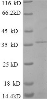 Recombinant Sulfolobus islandicus Chromatin protein Cren7 (creN7) – Figure 1 of 1