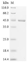 (Tris-Glycine gel) Discontinuous SDS-PAGE (reduced) with 5% enrichment gel and 15% separation gel.