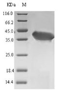 (Tris-Glycine gel) Discontinuous SDS-PAGE (reduced) with 5% enrichment gel and 15% separation gel.