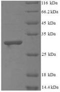 Recombinant Bacillus cereus Methylglyoxal synthase (mgsA) – Figure 1 of 1