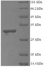 Recombinant Bacillus cereus Methylglyoxal synthase (mgsA) – Figure 1 of 1