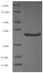 Recombinant Streptomyces actuosus Nosiheptide precursor (nosM) – Figure 1 of 1