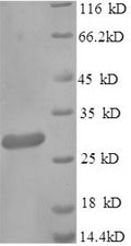 Recombinant Klebsiella pneumoniae Metallo-beta-lactamase type 2 (blaNDM-1) – Figure 1 of 1