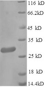 Recombinant Klebsiella pneumoniae Metallo-beta-lactamase type 2 (blaNDM-1) – Figure 1 of 1