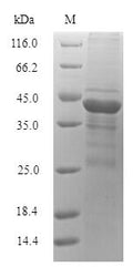 Recombinant Microbacterium testaceum N-acyl homoserine lactonase (aiiM) – Figure 1 of 1