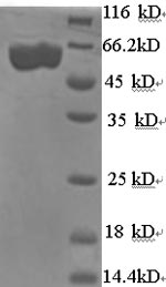 Recombinant Shigella flexneri serotype X E3 ubiquitin-protein ligase ipaH9.8 (ipaH9.8) – Figure 1 of 1