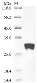 (Tris-Glycine gel) Discontinuous SDS-PAGE (reduced) with 5% enrichment gel and 15% separation gel.