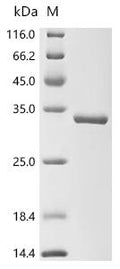 (Tris-Glycine gel) Discontinuous SDS-PAGE (reduced) with 5% enrichment gel and 15% separation gel.