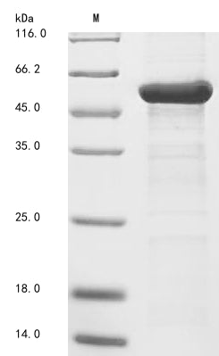(Tris-Glycine gel) Discontinuous SDS-PAGE (reduced) with 5% enrichment gel and 15% separation gel.