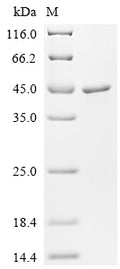 (Tris-Glycine gel) Discontinuous SDS-PAGE (reduced) with 5% enrichment gel and 15% separation gel.