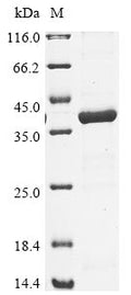 (Tris-Glycine gel) Discontinuous SDS-PAGE (reduced) with 5% enrichment gel and 15% separation gel.