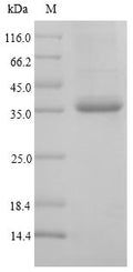 (Tris-Glycine gel) Discontinuous SDS-PAGE (reduced) with 5% enrichment gel and 15% separation gel.