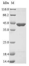 (Tris-Glycine gel) Discontinuous SDS-PAGE (reduced) with 5% enrichment gel and 15% separation gel.