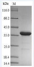 (Tris-Glycine gel) Discontinuous SDS-PAGE (reduced) with 5% enrichment gel and 15% separation gel.