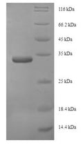 Recombinant Saccharomyces cerevisiae 26S proteasome regulatory subunit RPN13 (RPN13) – Figure 1 of 1