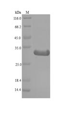 (Tris-Glycine gel) Discontinuous SDS-PAGE (reduced) with 5% enrichment gel and 15% separation gel.