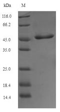 (Tris-Glycine gel) Discontinuous SDS-PAGE (reduced) with 5% enrichment gel and 15% separation gel.